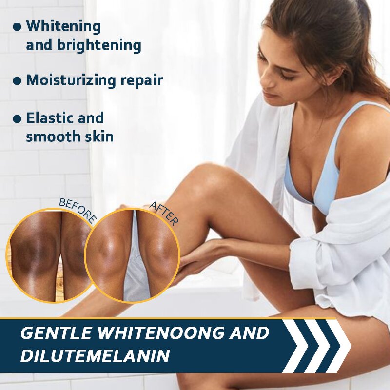 Whitening Face Cream - Manufacturer Vitamin C Collagen Rice Dark Spot Remover Bleaching