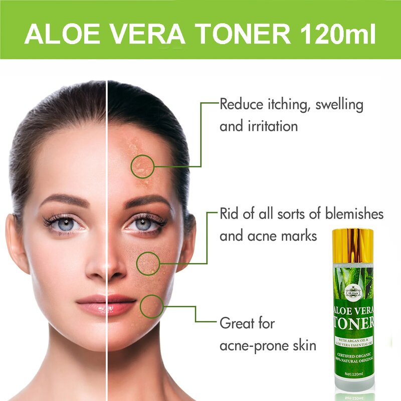 Aloe Vera Toner - Manufacturer OEM Private Label Repair Itching Swelling Acne Scar