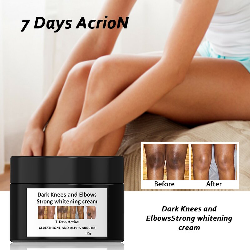 Whitening Face Cream - Manufacturer Vitamin C Collagen Rice Dark Spot Remover Bleaching