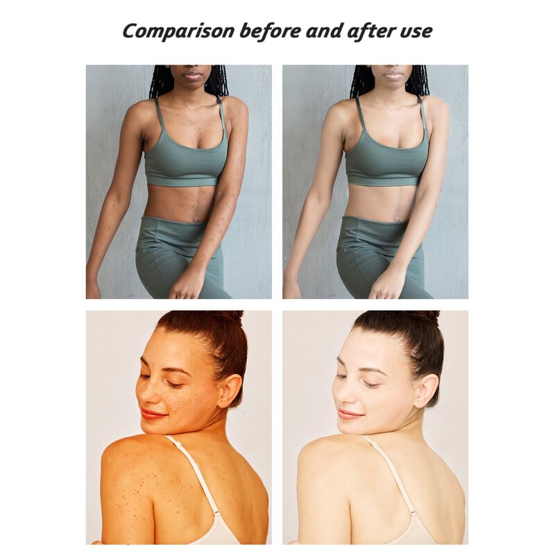 Amino Acid Serum - Manufacturer Revitalizer Dark Circles Anti-wrinkle Pigmentation