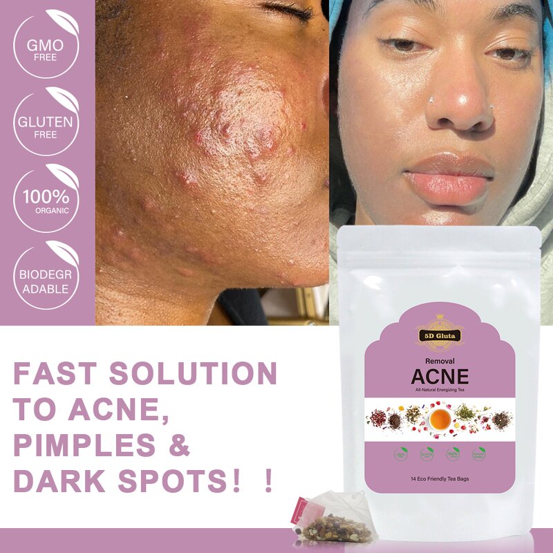 Beauty Tea Bag - Manufacturer Hot Sell Organic All-Natural Detox Glow Skin Whitening