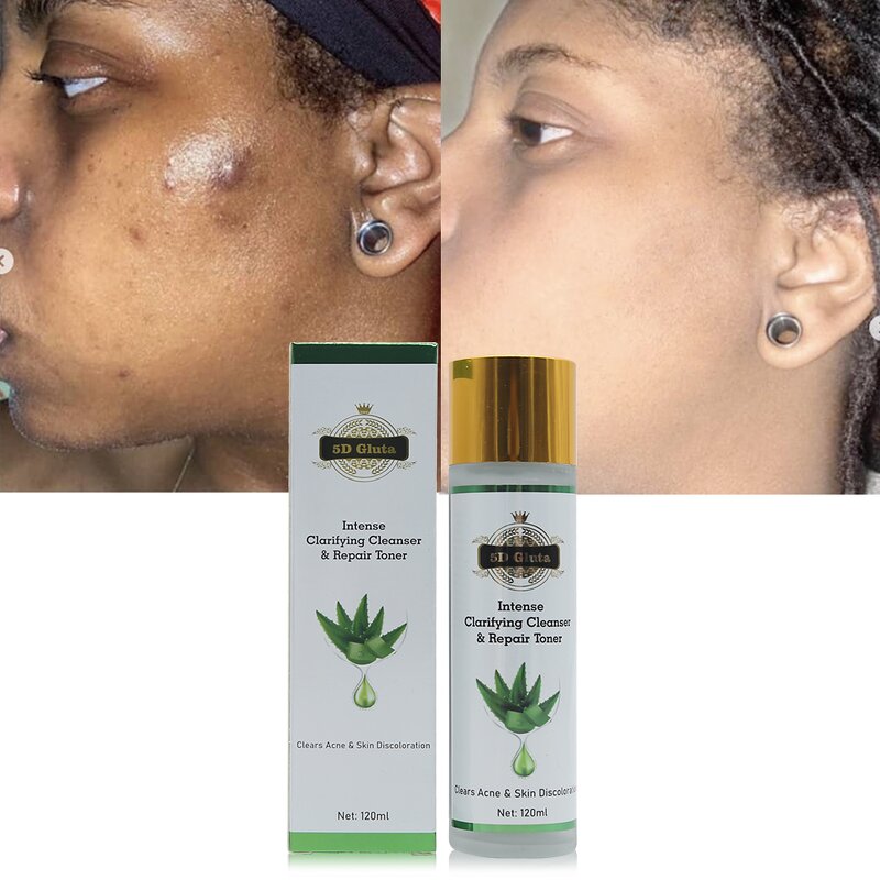 Clarifying Cleanser Toner - Manufacturer Lightening Radiance Removing Impurities Gluta