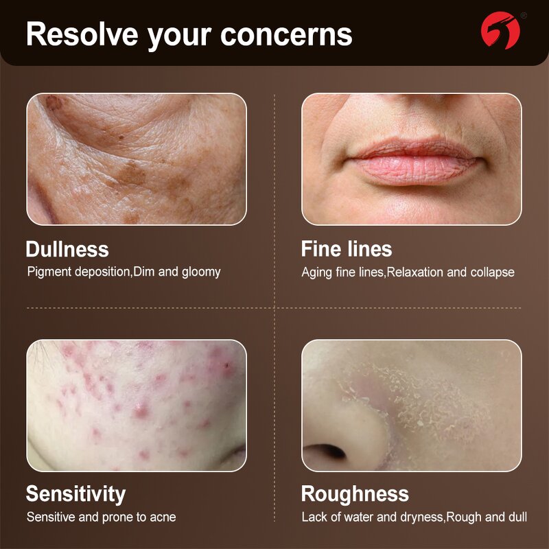 Angelica Extract Capsules - Manufacturer Natural Beauty Skin Whitening Freckle