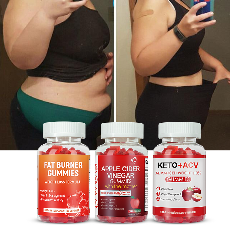 Apple Cider Vinegar Gummies Manufacturer - OEM/ODM Vegan Apple Flavor