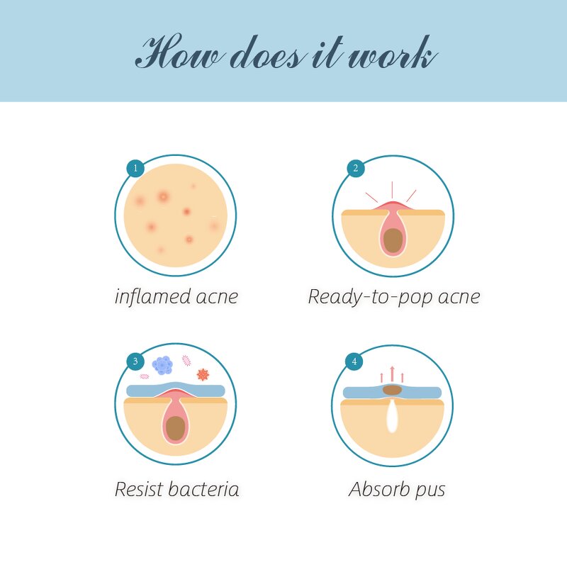 Pimple Removal Patch Manufacturer - Hot Selling Customized Collagen Vitamin C Infused Invisible