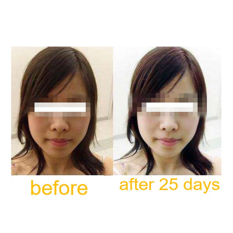 L-Glutathione Capsules Manufacturer - OEM Reduced with ALA Vitamin C or Grape Seed Extract