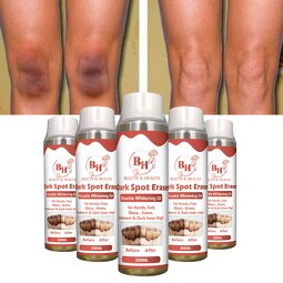 Dark Spot Removal Oil Supplier - Private Label Beauty Body Care Oil