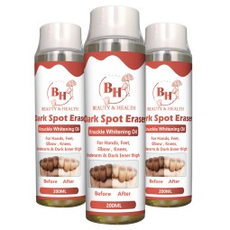 Knuckle Whitening Cream Supplier - OEM Dark Skin Elbow Knee Serum