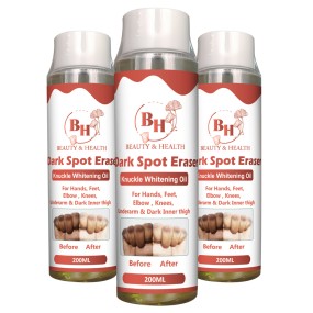 Knuckle Whitening Cream Supplier - OEM Dark Skin Elbow Knee Serum