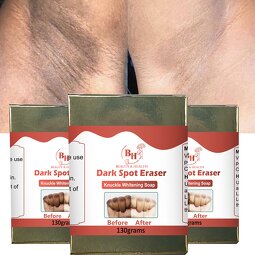 Knuckle Whitening Soap Supplier - Wholesale Dark Spot Removal Soap