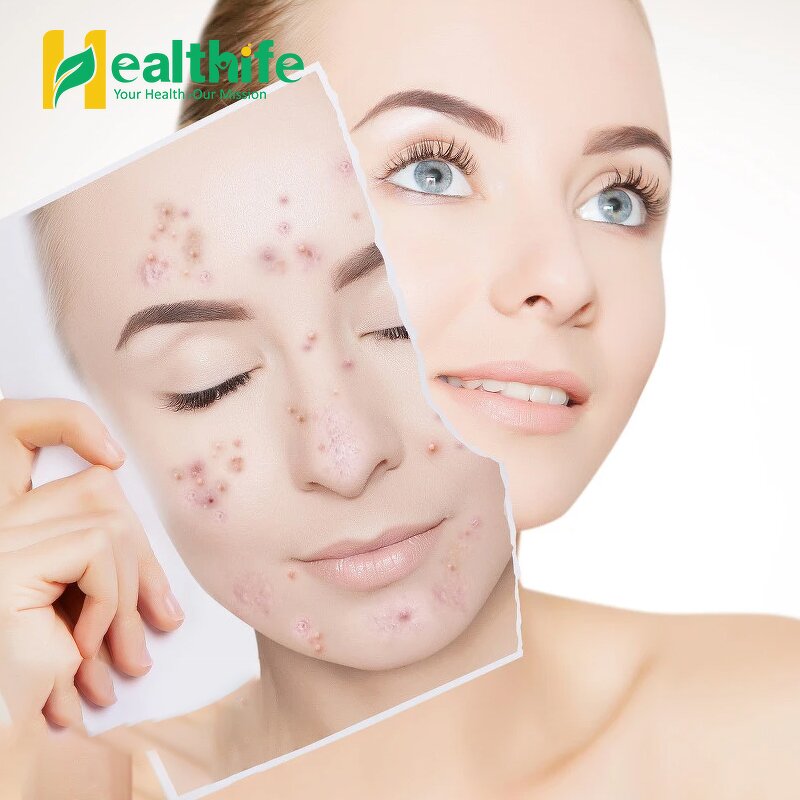 Nigella Sativa Extract Manufacturer - Natural High Concentrate Thymoquinone for Hair