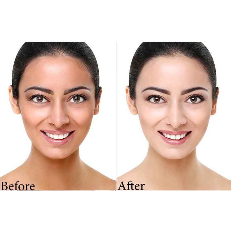 Kojic Acid Powder - Manufacturer Wholesale Top Grade Skin Whitening