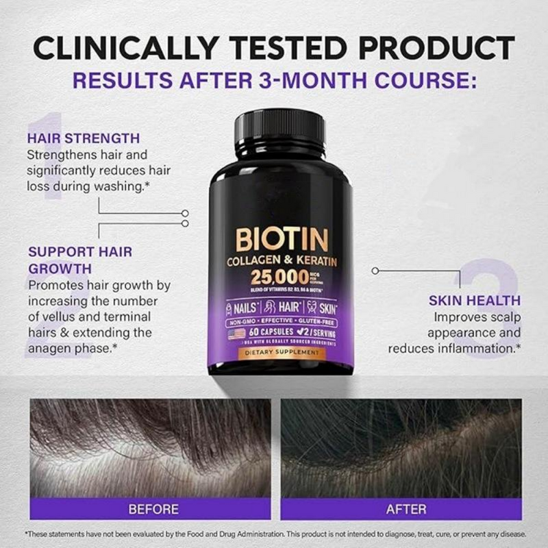 Biotin Capsules Manufacturer - OEM Private Label for Hair Nail & Skin Health with Collagen