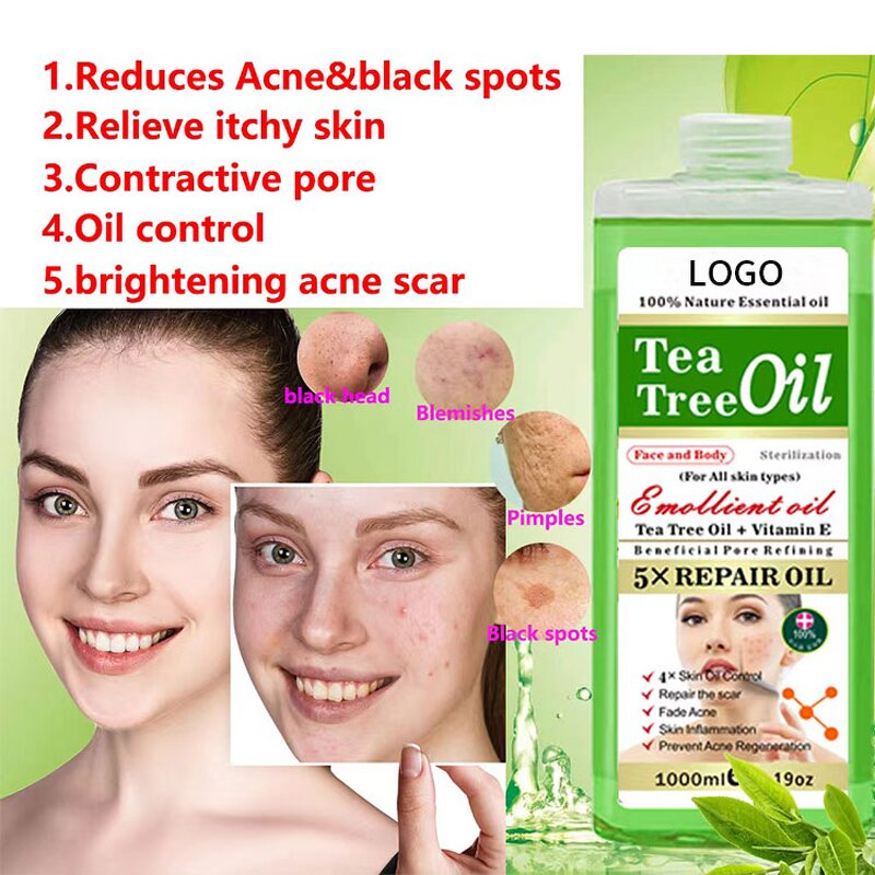 Alpha Arbutin Essential Oil - Manufacturer OEM 1000ml Skin Whitening Lightening