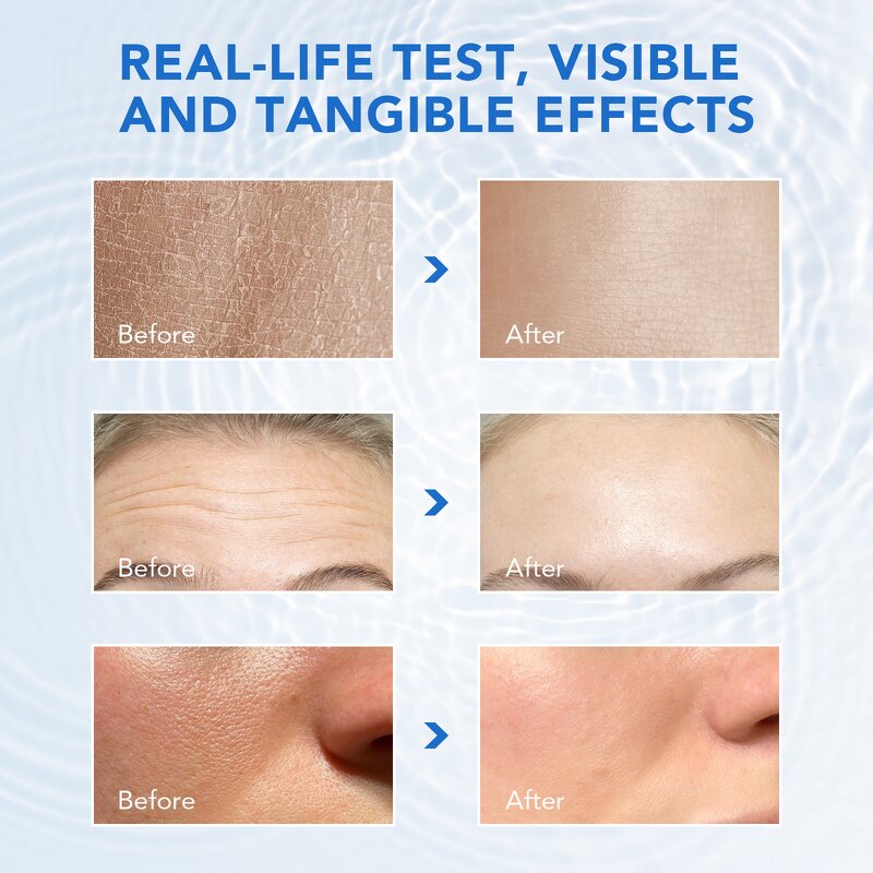 Serum Manufacturer - Ultra-Hydrating Vials 3% Hyaluronic Acid Single-use Capsule