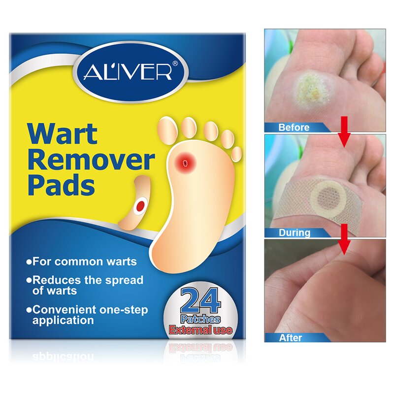 Wart Remover Pad - Wholesale 24 Count Corn Callus Feet Hand Skin Care Solution
