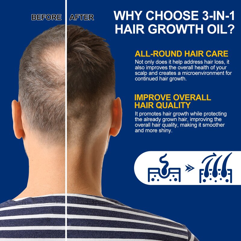 Castor Oil Manufacturer - Private Label Fast Hair Growth Beard Eyelash Repair