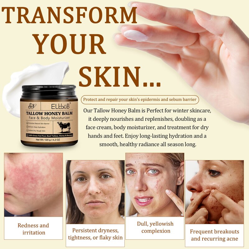 Tallow Cream - Wholesale Whipped 100% Grass-Fed Beef Tallow Honey Balm Hydrating