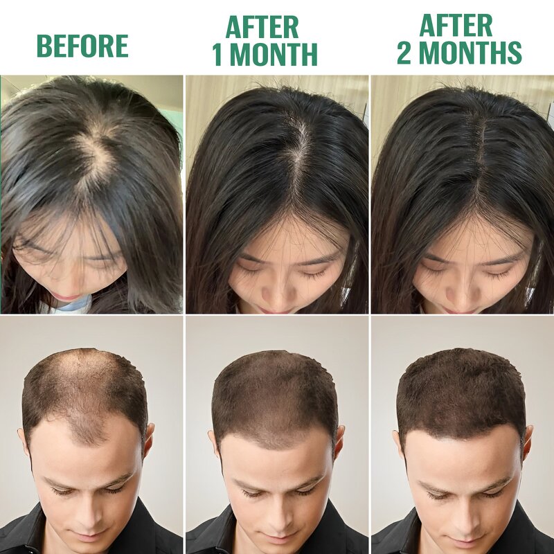 Hair Oil Spray - 120ml Natural Batana Rosemary Fast Hair Growth Scalp Care