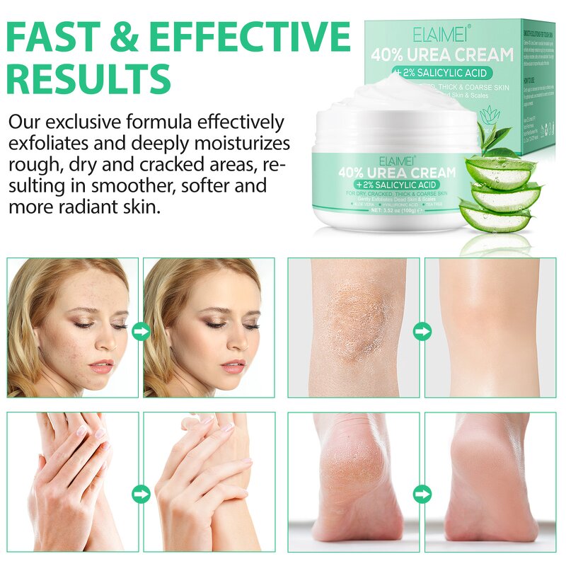 Urea Cream Manufacturer - 40% Urea Foot Repair 2% Salicylic Acid Cracked Heels