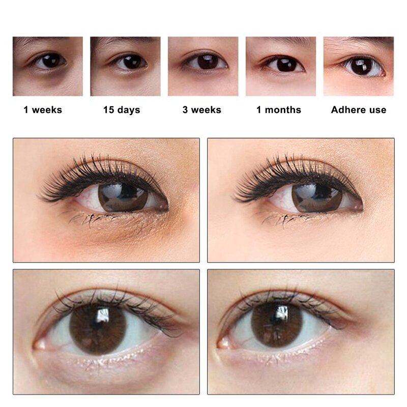 Eye Mask Manufacturer - Private Label 24k Gold Crystal Collagen Dark Circles