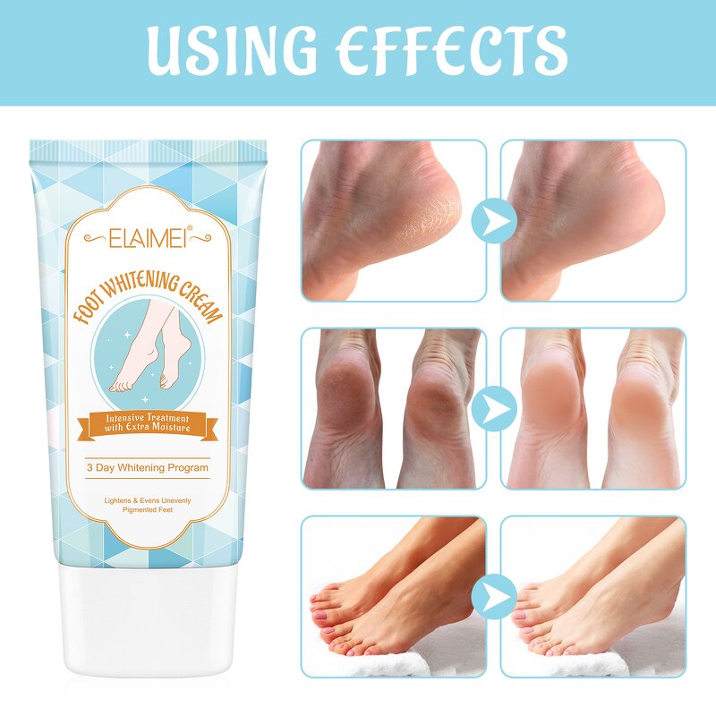 Repair Cream - 3 Days Hand Foot Whitening Cracked Dry Skin Moisturizing