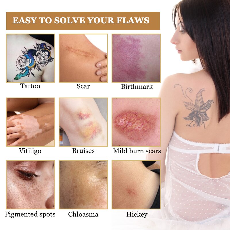 Concealer Cream - Invisible Tattoo Scar Birthmark Stretch Long Lasting Waterproof