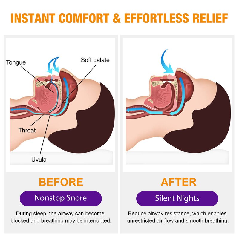 Anti Snoring Spray - Wholesale Natural Throat Breathing Relief Nasal Mist for Men Women