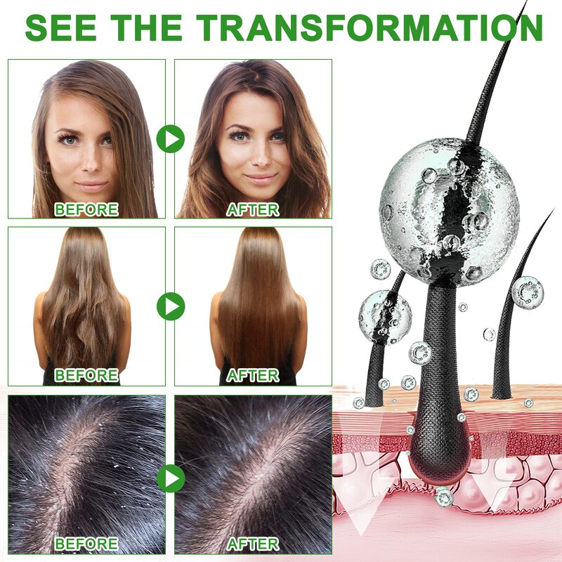 Rosemary Cream - Organic Solid Hair Growth Oil Ointment Thin Hair Batana