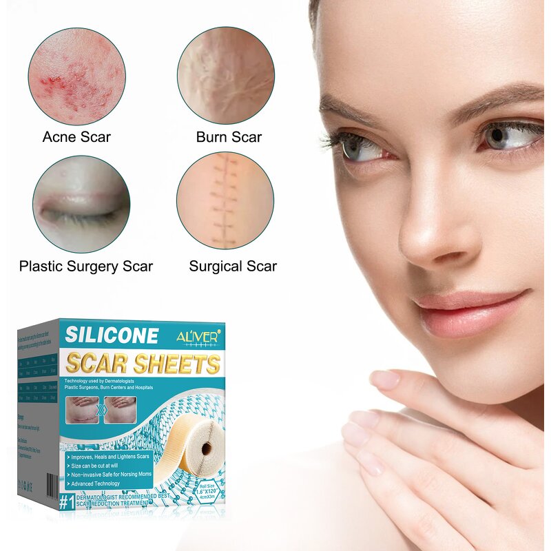 Scar Sheet Manufacturer - Wholesale Silicone Scar Roll Patch Removal Gel Skin Care