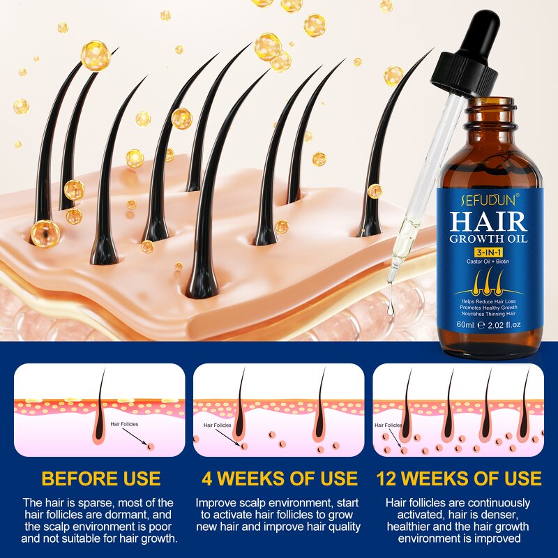 Castor Oil Manufacturer - Private Label Fast Hair Growth Beard Eyelash Repair