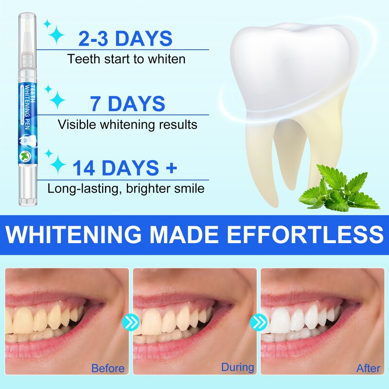 Teeth Whitening Pen - Wholesale 6pcs Instant Stain Remover Fresh Mint Sensitive
