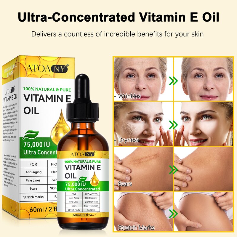 Vitamin E Oil - Private Label 75,000 IU Cold Pressed Vegan Dry Damaged Skin