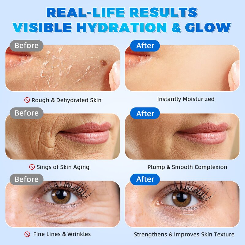 Serum Manufacturer - 3% Hyaluronic Acid 24H Moisturizing Anti Wrinkle Whitening