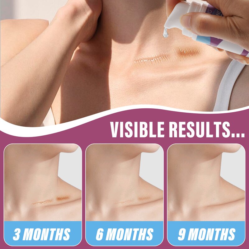 Scar Gel Manufacturer - Premium Skin Care Scar Removal Pimples Acne Silicone Gel