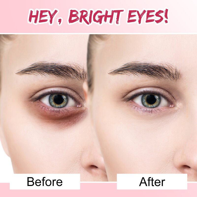 Eye Pad Manufacturer - Wholesale 100 Pairs Anti-Puffiness Hydrogel Eyelash Extension