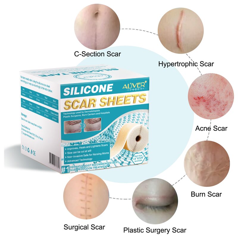 Scar Sheet Manufacturer - Wholesale Silicone Scar Roll Patch Removal Gel Skin Care