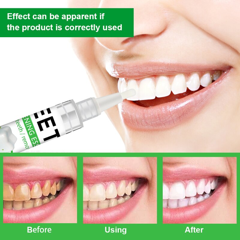 Teeth Whitening Pen - Wholesale Professional Dazzling White Gel Pen for Teeth