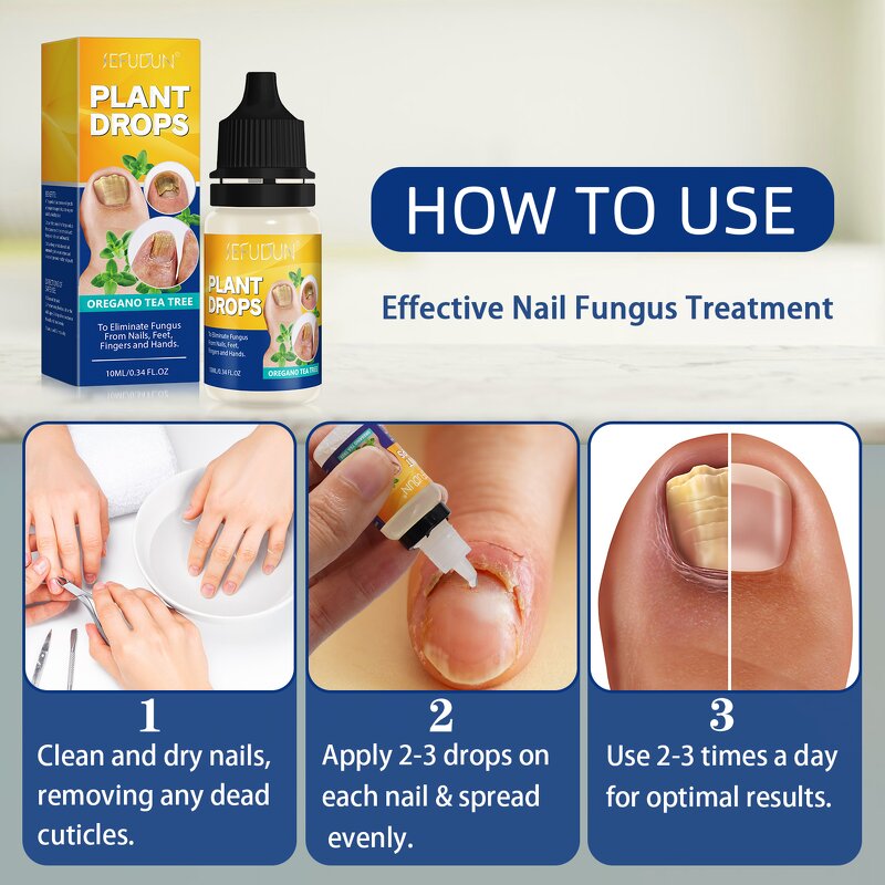 Nail Care Liquid - Wholesale Oregano Tea Tree Plant Drops Toenail Growth Repair