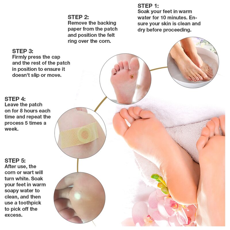 Wart Remover Pad - Wholesale 24 Count Corn Callus Feet Hand Skin Care Solution