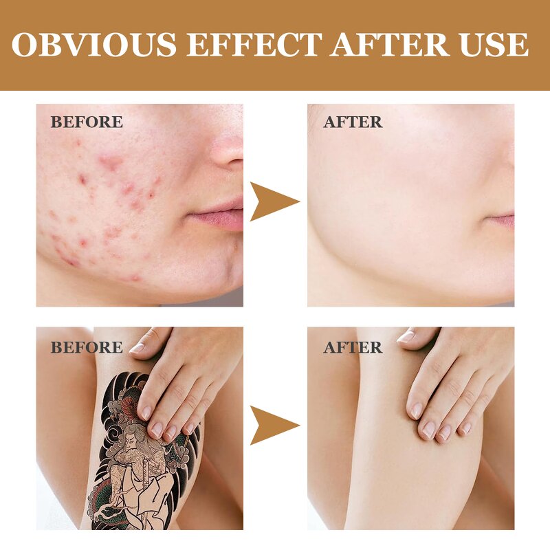 Concealer Cream - Invisible Tattoo Scar Birthmark Stretch Long Lasting Waterproof