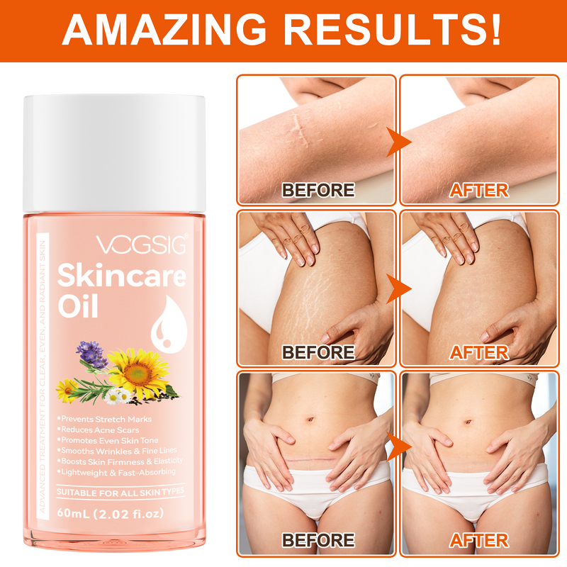 Body Oil Manufacturer - Natural Moisturizing Anti-aging Scars Stretchmarks Smoothing