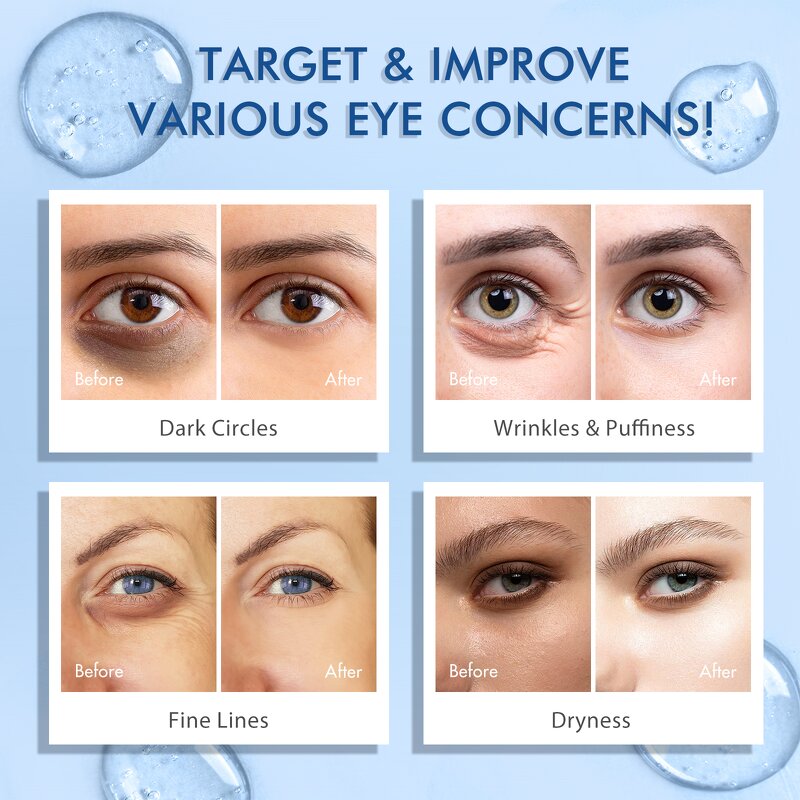 Eye Serum Manufacturer - Caffeine 360 Roller Anti-aging Dark Circle Removal