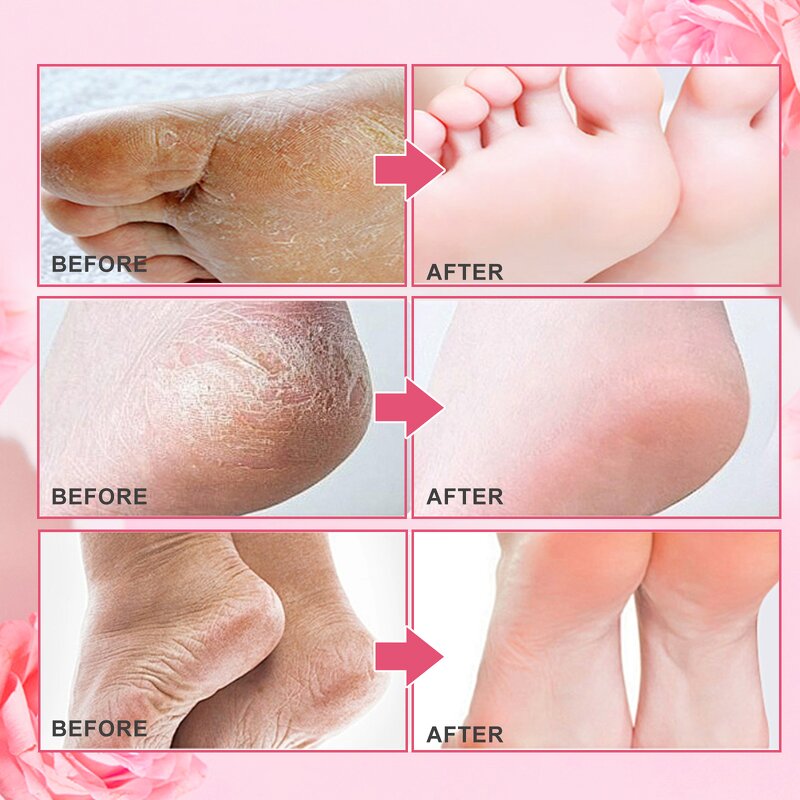 Foot Mask Manufacturer - Nourishing Exfoliating Peeling Collagen Dead Skin Removal