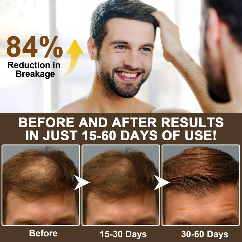 Hair Shampoo - Wholesale 300ml Bioton Caffeine Hair Loss Prevent Growth