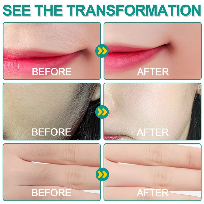 Dermaplaner Spray - OEM Hair Removal Custom Logo Body Face Shaving Set