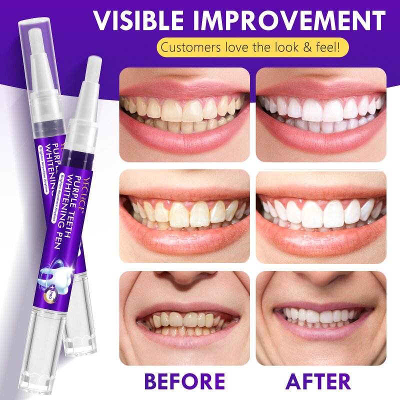 Teeth Whitening Pen - YECUCE 6PCS Mint Professional Stain Remover Home Use
