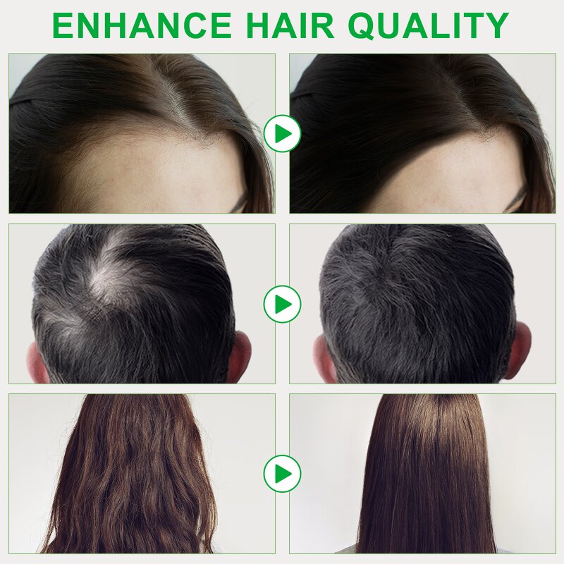 Batana Oil - Wholesale HUALIJIA 100% Raw Natural Hair Growth Lokshair