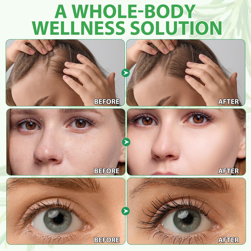 Essential Oil - NIFEISHI 60ml Monarda CO2 Extraction Anti-Wrinkle Hair Growth