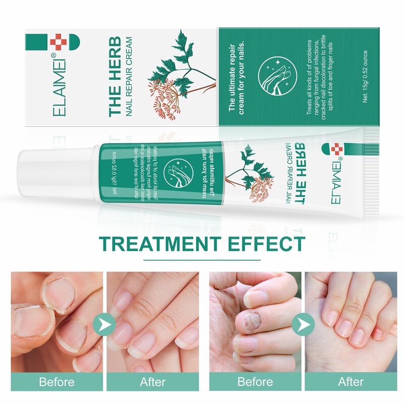 Nail Serum - 30ml Natural Anti Fungal Nail Repair Essence Oil Treatment